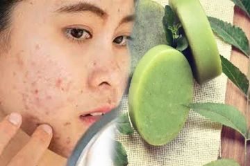 முகப்பருவை மறைய செய்யும் வேப்பிலை Soap; வீட்டில் செய்வது எப்படி?