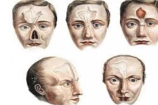 பிளாஸ்டிக் சர்ஜரி செய்துக்கொண்ட இளம் பெண்கள்! 69,000 கருத்தடை மாத்திரைகளை வைத்து ஆசாமி செய்த மோசமான செயல்? அதிர்ந்து போன நீதி மன்றம்