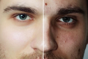 ஒரே வாரத்தில் இப்படி இருந்த உங்க முகம் மாறனுமா? இந்த 1 விதையை மட்டும் வீட்டுல வச்சுக்கோங்க!