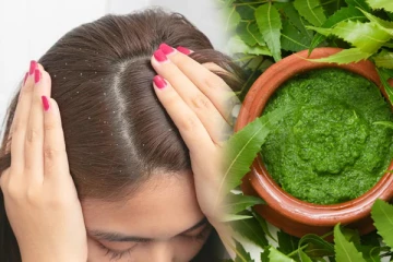 பொடுகு தொல்லையை நிரந்தரமாக போக்க வேண்டுமா? அப்போ வேப்ப இலையை இப்படி பயன்படுத்தி பாருங்க