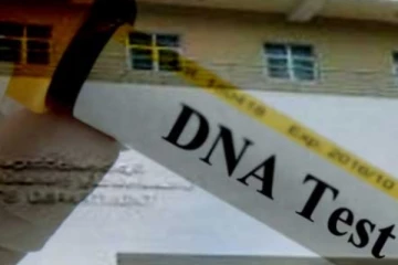 DNA පරීක්ෂණ වලට බාධාවක් -  DNA විශ්ලේෂණ අංශ මඟින් දැනුම්දීමක්..!
