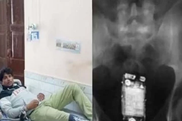 செல்போனை கடித்து தின்ற இளைஞர்! பகீர் காரணம் இதோ