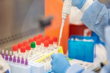 நாட்டில் நேற்று குறைந்தளவில் முன்னெடுக்கப்பட்டுள்ள அன்டிஜன் மற்றும் பி.சி.ஆர் சோதனைகள்