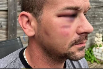 லண்டனில் கால் வைத்ததுமே புலம்பெயர்ந்தோருக்கு கிடைத்த பயங்கர அனுபவம்: வெளியான அதிரவைக்கும் காட்சிகள்