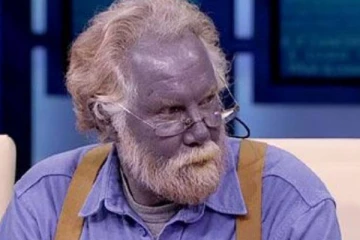 அமெரிக்காவில் திடீரென நீல நிறமாக மாறிய முதியவரின் தோல்! அதிர்ச்சி காரணம்