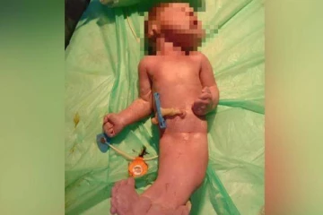 மீன் போன்று பிறந்த குழந்தை! 2 மணிநேரத்தில் உயிரிழந்த பரிதாபம்