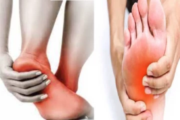 அடிக்கடி பாத எரிச்சல் வருதா? அப்போ இந்த நோய் உள்ளதாம்