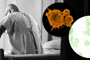 මෙරට පිළිකා අවධානම ගැන සෞඛ්‍ය අමාත්‍යාංශයෙන් කළ අනාවරණය.