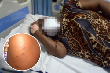 ஒரே நாளில் இரண்டு டோஸ் கொரோனா தடுப்பூசிகளையும் போட்டுக்கொண்ட பெண்! பின்னர் நடந்த விபரீதம்