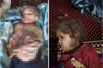 பச்சிளம் குழந்தைகளை கொன்று குவிக்கும் தலிபான்கள்! வெளியான கதிகலங்க வைக்கும் புகைப்படங்கள்