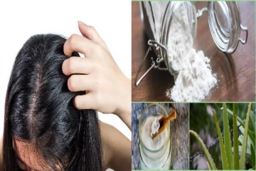 தீராத பொடுகுத் தொல்லையா! இதோ உங்களுக்கான தீர்வு