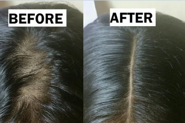 உங்க முடி கருகருன்னு காடு மாதிரி அடர்த்தியா வளரணுமா? அப்ப இந்த ஒரு ஹேர் மாஸ்க் மட்டும் யூஸ் பண்ணங்க!