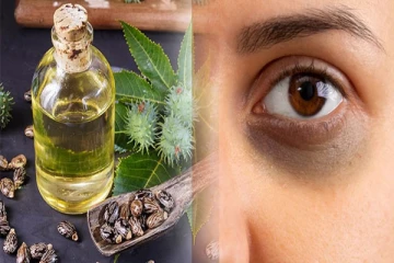 கருவளையம் வந்து முகம் பொலிவு இல்லாமல் இருக்கா?