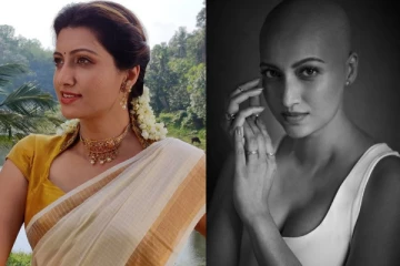 நான் ஈ பட நடிகைக்கு என்னாச்சு.. புகைப்படம் பார்த்து பதறிப்போன ரசிகர்கள்