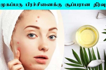Beauty Tips: ஒரே இரவில் முகப்பரு மறைய வேண்டுமா? இந்த இரண்டு பொருள் மட்டும் போதும்