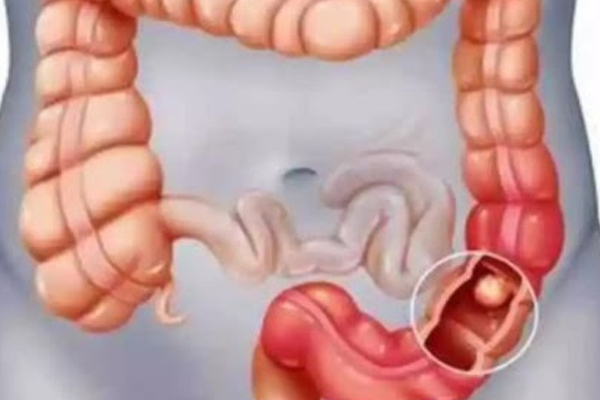 கருவை வலிமை அடையச் செய்யும் கீரை | Lettuce Which Strengthens The Fetus