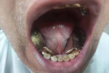 வாயில் ஒரு கிலோ தங்கம்: அதிர வைத்த பலே கடத்தலால் ஆடிப்போன அதிகாரிகள்