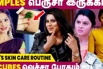Pimples பெருசா இருக்கா - Delna Davis Interview