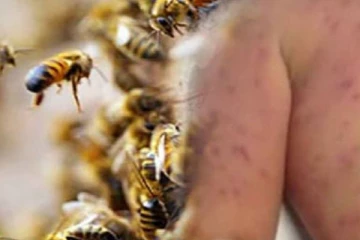 බඹර ප්‍රහාරයකින් 40 දෙනෙකු රෝහල් ගත කරයි..