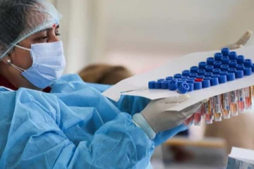 இலங்கையில் நியோகோவ் வைரஸ் பரவும் அபாயம்