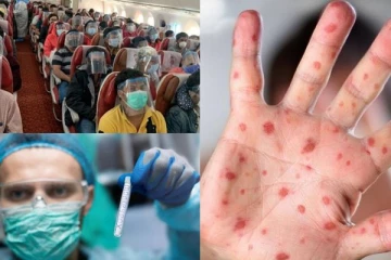 குரங்கம்மை பாதிப்பில் 98% நபர்கள் ஓரினசேர்க்கையாளர்கள்...ஆய்வு கூறும் அதிர்ச்சி தகவல் - ஏன்?