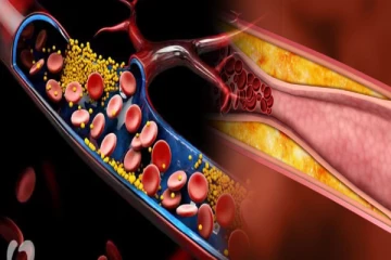அதிக கொலஸ்ட்ரோலை குறைக்கும் சிறப்பான ஆயுர்வேத மூலிகைகள்