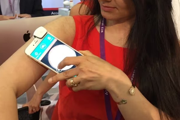 புற்று நோயை கண்டறியும் செயலியை கண்டு பிடித்த கனடியர் | Toronto Engineer Develops App Diagnose Skin Cancer