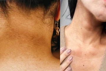 5 ரூபாய் இருந்தால் போதும்; கருமையான கழுத்து பளபளப்பாகும், எப்படி தெரியுமா?