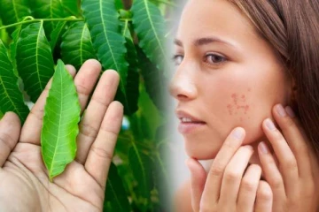 ஒரே வாரத்தில் கரும்புள்ளிகளை நீக்க இந்த ஒரு இலை போதும்.., எப்படி பயன்படுத்துவது?