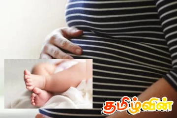 இலங்கையில் எடை குறைந்த குழந்தைகளின் பிறப்பு வீதம் அதிகரிப்பு