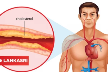 கொலஸ்ட்ராலை வேகமாக குறைக்க வேண்டுமா? அப்போ இந்த உணவுகளை கட்டாயம் எடுத்துகோங்க