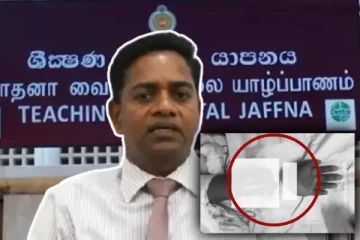 யாழ்.போதனா வைத்தியசாலையின் சாதனை: இரண்டு துண்டாகிய கை பொருத்தி சத்திரசிகிச்சை