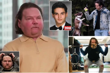 உலகின் முதல் இரு கைகள் மற்றும் முகம் மாற்று அறுவை சிகிச்சை பெற்ற நபர் இவர்தான்