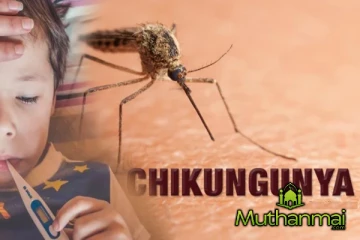 சிக்குன்குனியா வைரஸ் தொற்று தொடர்பில் அவதானம்