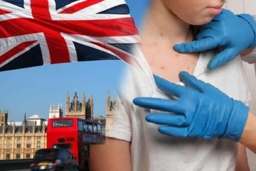 பிரித்தானியாவை அச்சுறுத்தும் நோய்த்தாக்கம்: விடுக்கப்பட்டுள்ள சுகாதார எச்சரிக்கை