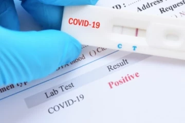 போலியான  பிசிஆர்  பரிசோதனை அறிக்கை! மக்களே அவதானம்