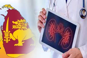 நாட்டில் 10 வீதமானவர்களுக்கு சிறுநீரக நோய்