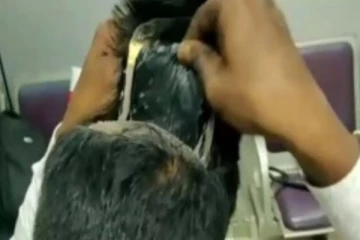 வினோதமாக தோன்றிய தலை... சோதனை செய்த அதிகாரிகளுக்கு ஏற்பட்ட பேரதிர்ச்சி