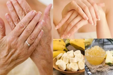 கைகளில் அதிகமாக சுருக்கம் இருக்கா? அப்போ இந்த டிப்ஸ Follow பண்ணுங்க