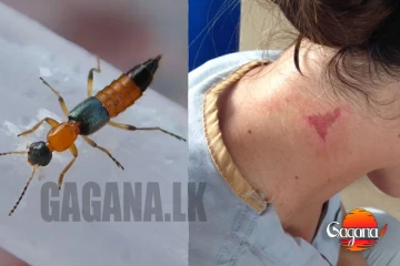 කොරෝනා මදිවට ඒ පාර තව ලෙඩක්