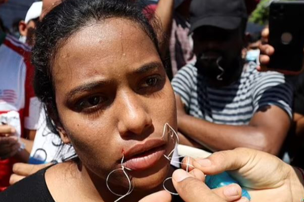தங்கள் கோரிக்கைக்கு அனுமதியளிக்காததால் வாயை ஊசி நூலால் தைத்துக்கொண்ட புலம்பெயர்வோர் சிலர்: ஒரு பயங்கர சம்பவம் | Igrants Sew Mouths Shut Quest Mexico Passage