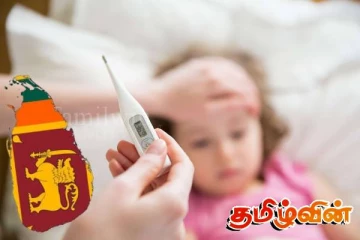 சிறுவர்கள் மத்தியில் வேகமாக பரவும் வைரஸ் தொற்று : விடுக்கப்பட்டுள்ள எச்சரிக்கை