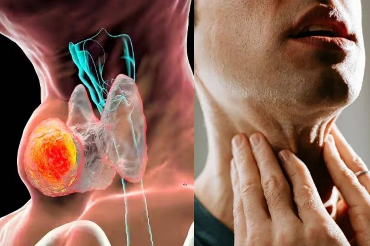 இந்த அறிகுறிகளை புறக்கணிக்காதீர்... புற்றுநோயாக கூட இருக்கலாம் | Cancer Symptoms In Tamil