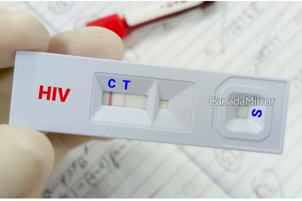 பிரிட்டிஷ் கொலம்பியாவில் எய்ட்ஸ் குறித்து எச்சரிக்கை | Hiv Spike Among B C Drug Users