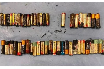 55 பேட்டரிகளை விழுங்கிய 65 வயது பெண் - காரணம் என்ன? மருத்துவர்களின் சாதனை!