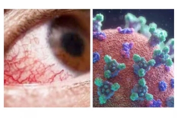 கருப்புப் பூஞ்சை நோயால் 30 பேருக்கு கண் பார்வை பறிபோனது - கோவை அரசு மருத்துவமனை அதிர்ச்சி தகவல்