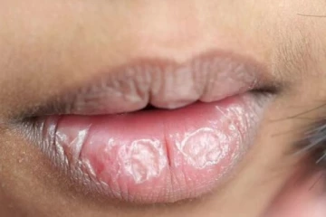 கருப்பு உதடு சிவப்பாக மாற வேண்டுமா? உடனே இந்த எளிய முறையை செய்தால் போதும்!