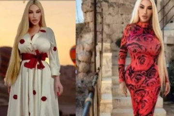 100க்கும் மேற்பட்ட பிளாஸ்டிக் சர்ஜரிகளுக்கு ரூ.10 கோடி செலவு செய்த பெண்.., யார் இவர்?