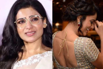 3 வருட நரக வேதனை.. நடிகை சமந்தாவை போல் விசித்திர நோயால் அவதியுறும் விஜய் பட நடிகை!