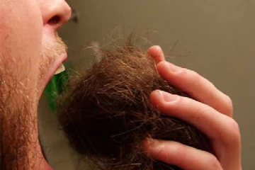 உணவிற்கு பதிலாக தலைமுடியை சாப்பிடும் அரிய வகை நோய்! அதிர்ச்சி கொடுத்த மருத்துவர்கள்